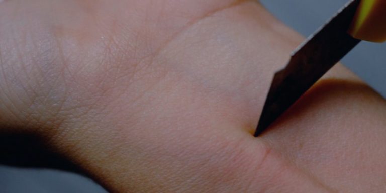 Sintomas, características y tratamientos del «cutting»